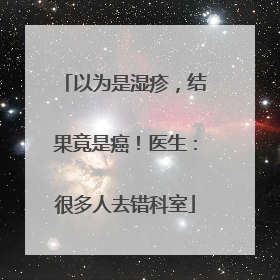 以为是湿疹，结果竟是癌！医生：很多人去错科室